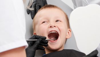 The Pros and Cons of Dental Sealants
