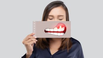 What Are the Tips for Preventing Receding Gums?